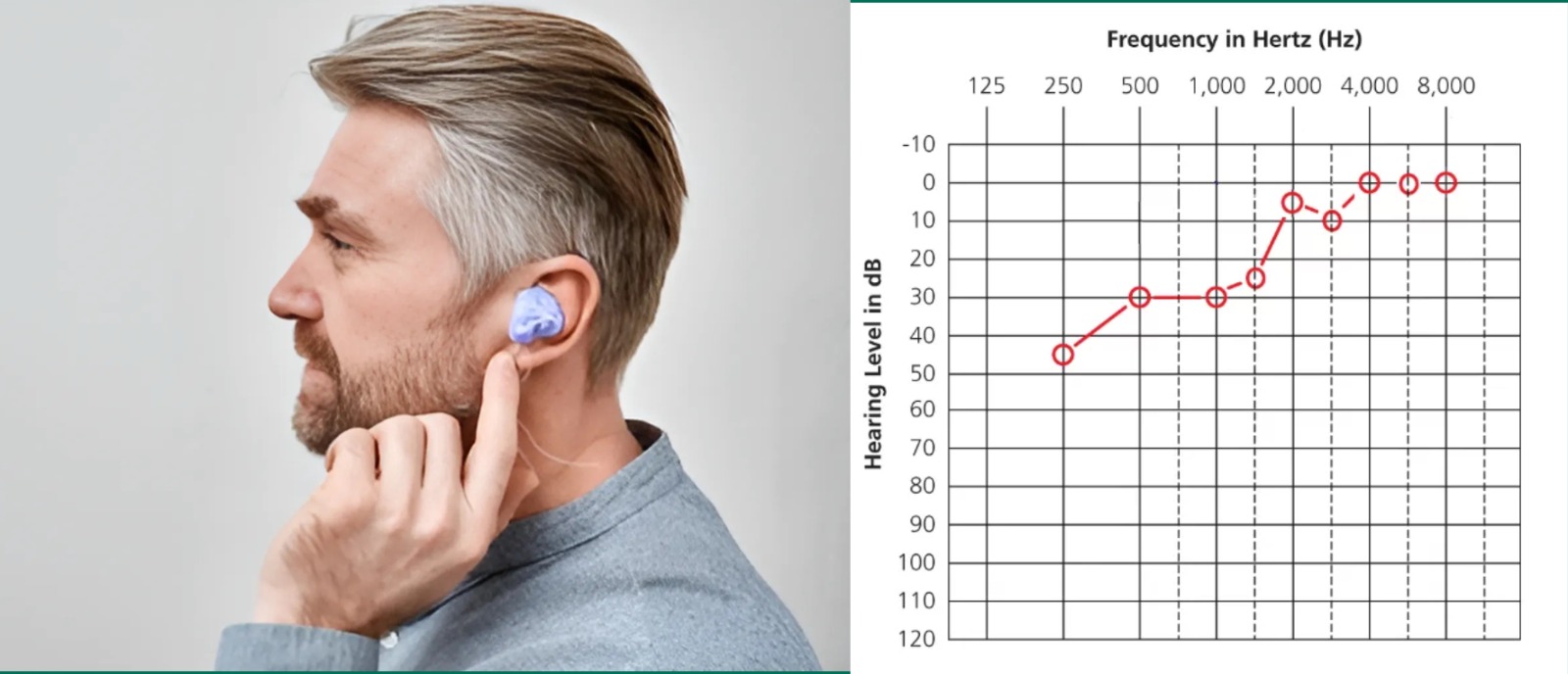 Why you're hearing echoes with hearing aids – the occlusion effect and what causes it